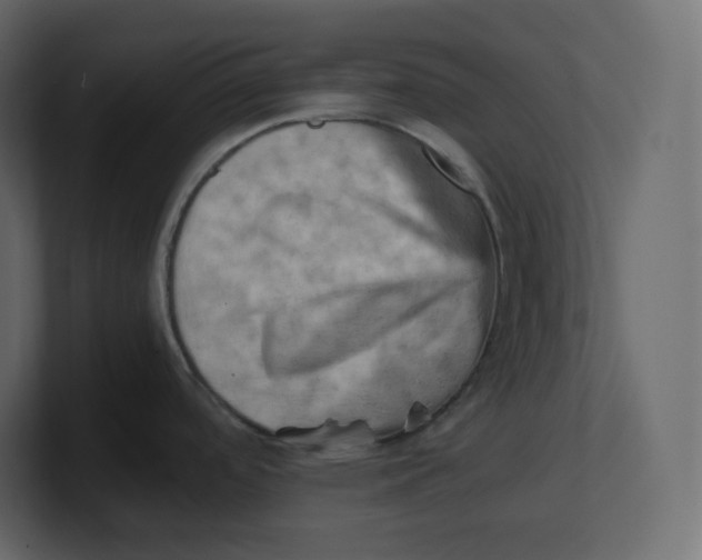 X0000100931488200807151233