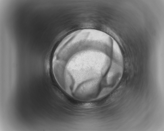 X0000100930059200807221145