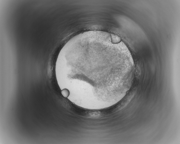 X0000100930355200807221142