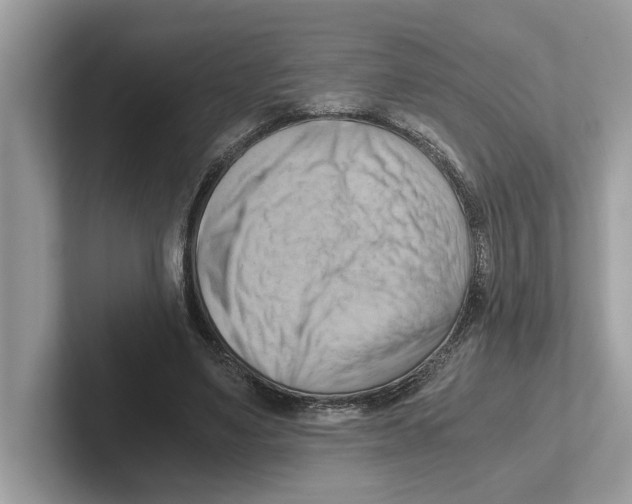 X0000100930491200807221140