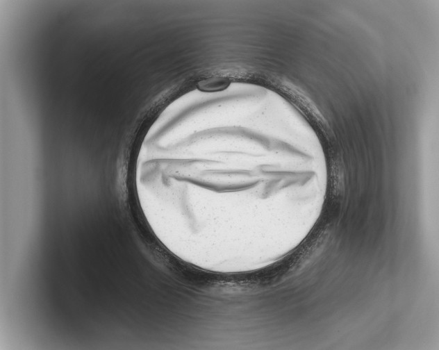 X0000100930538200807221139