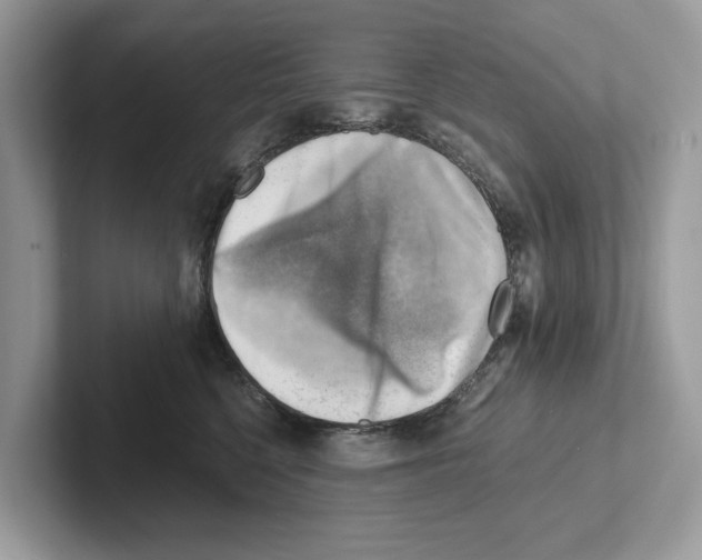 X0000100930568200807221139