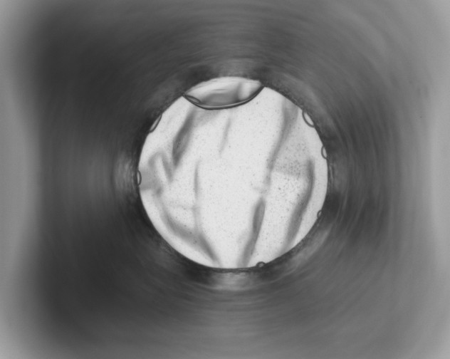 X0000100930575200807221140