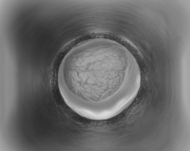 X0000100930775200807221136