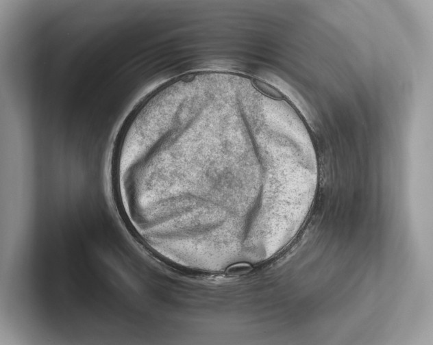 X0000100931139200807221131