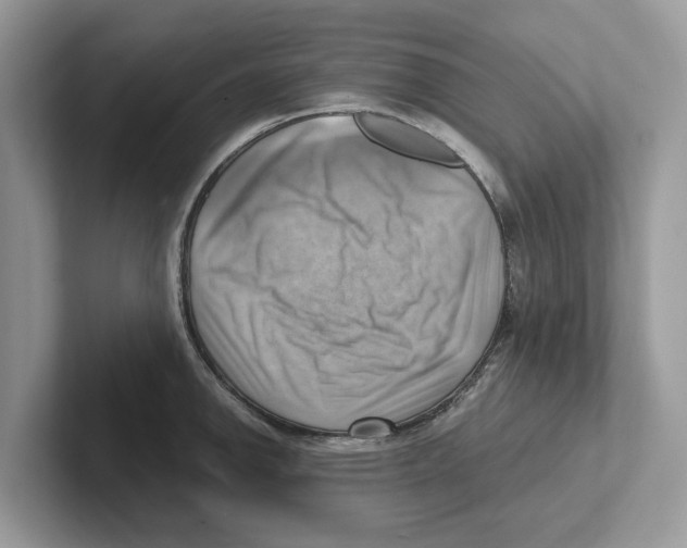 X0000100931142200807221131