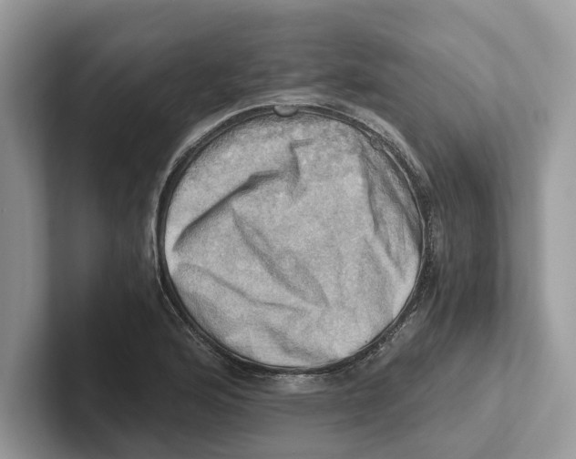 X0000100931176200807221131