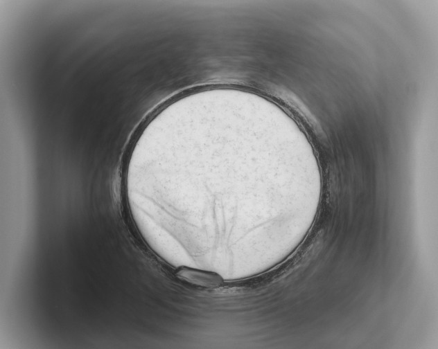 X0000100931268200807221129