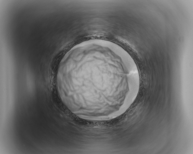 X0000100931399200807221127