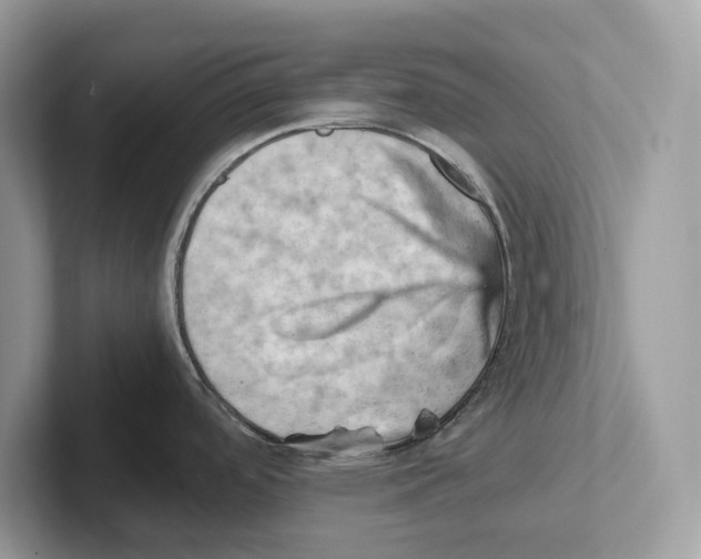 X0000100931488200807221126