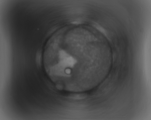 X0000100940297200807081241