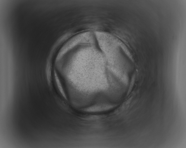 X0000100940149200807151313