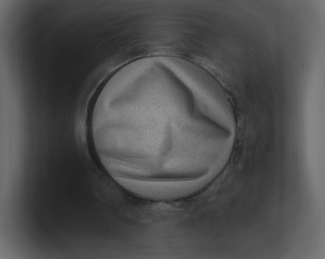 X0000100940290200807151312