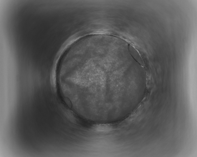 X0000100940296200807221203