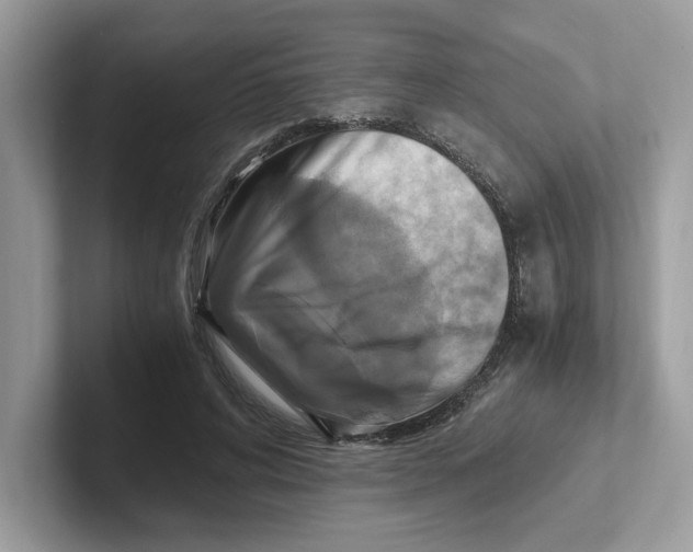 X0000100940592200807221159