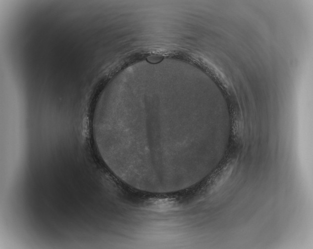 X0000100940689200807221158