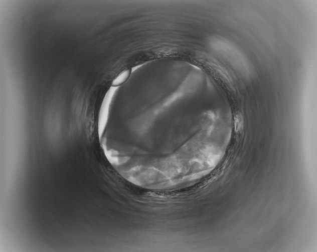 X0000100941011200807221153