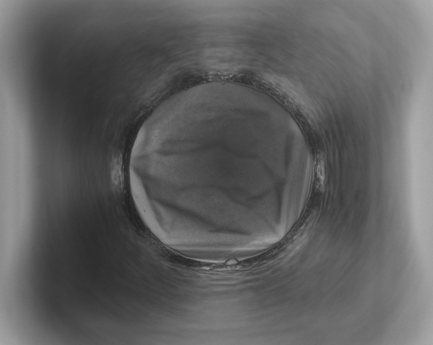 X0000100941252200807221150