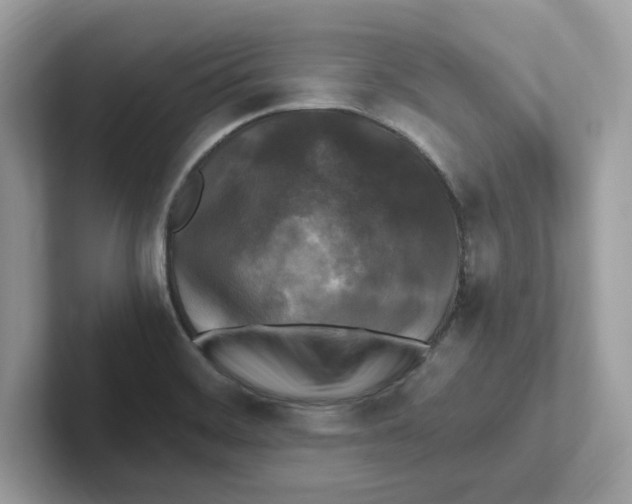 X0000100941468200807221147