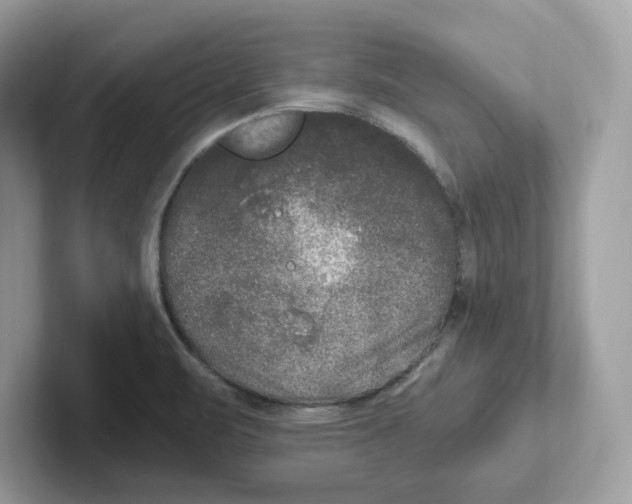 X0000100941471200807221147