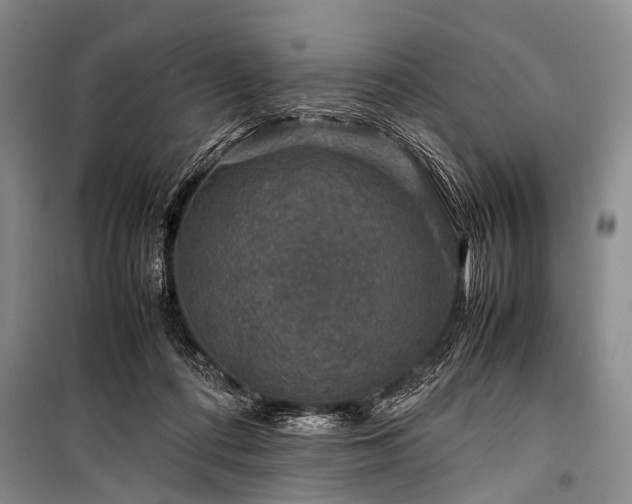 X0000100950312200807011315