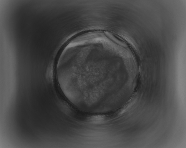 X0000100950156200807151344