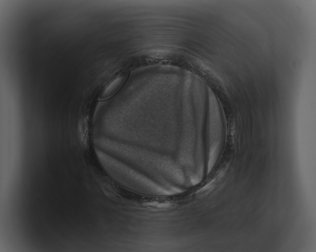 X0000100950868200807151335