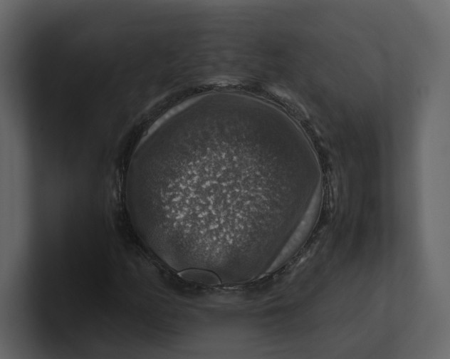 X0000100951158200807151331