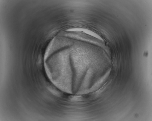 X0000100950132200807221130