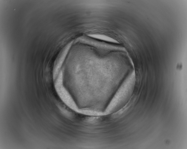 X0000100950136200807221130