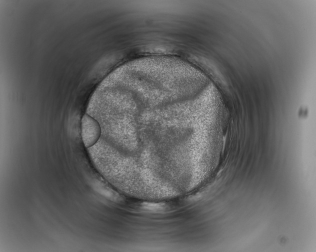 X0000100950457200807221125