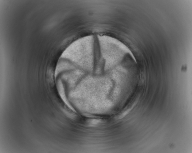 X0000100950575200807221124