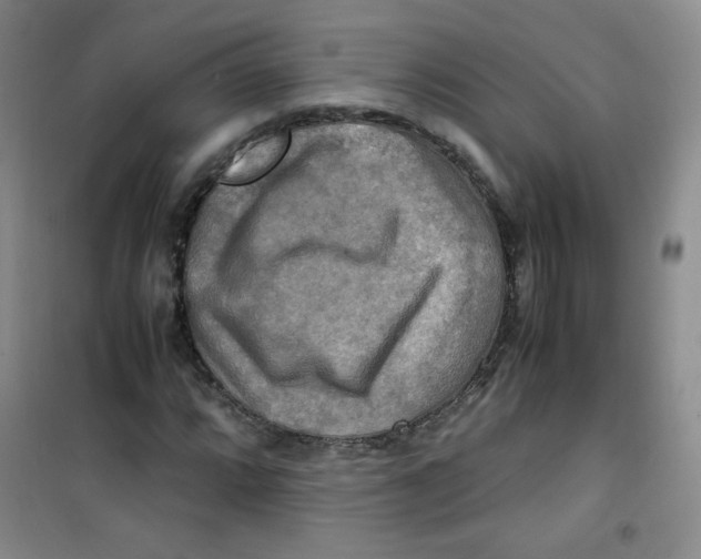 X0000100951064200807221116