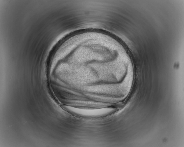 X0000100951118200807221114