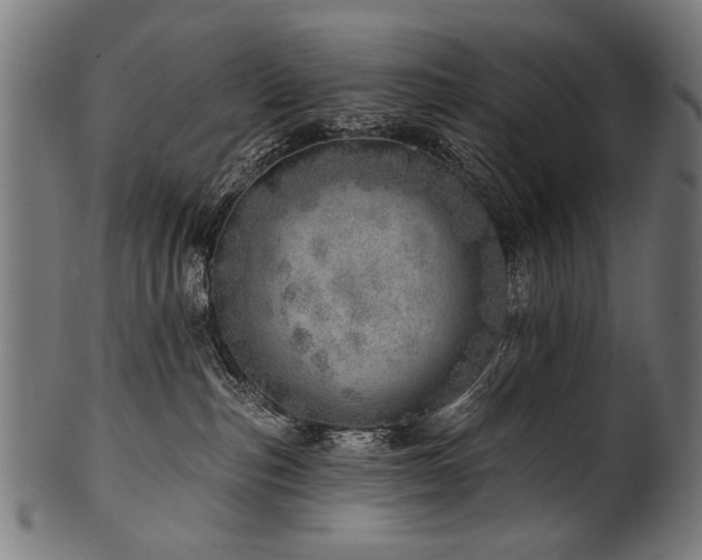 X0000100960187200806241536