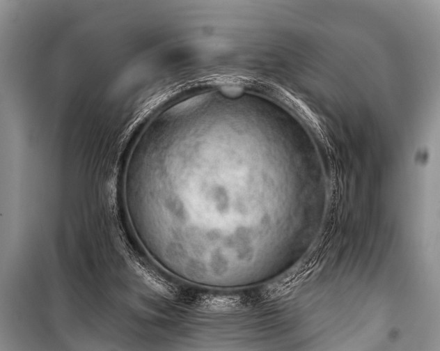 X0000100960155200807011340
