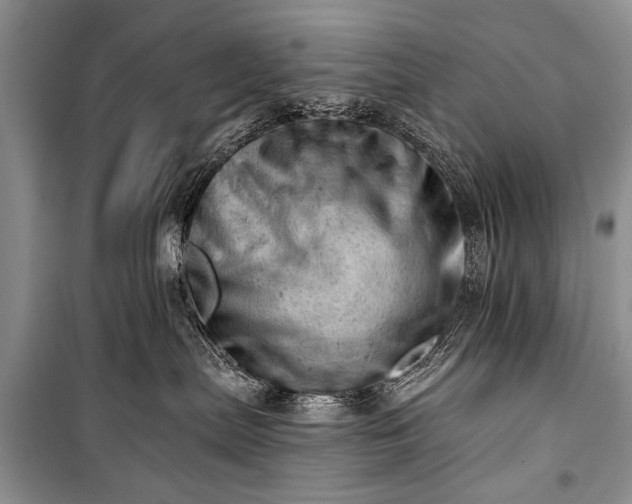 X0000100960287200807011340