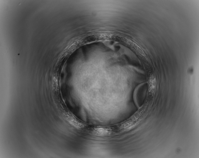 X0000100960522200807011335