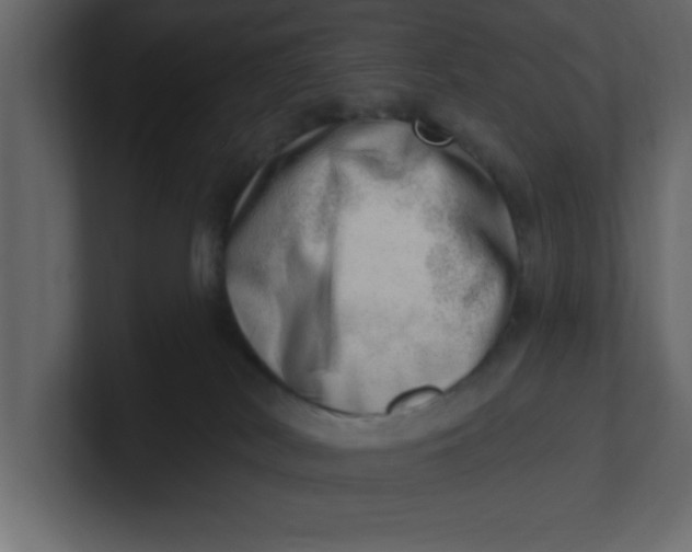 X0000100960038200807151408