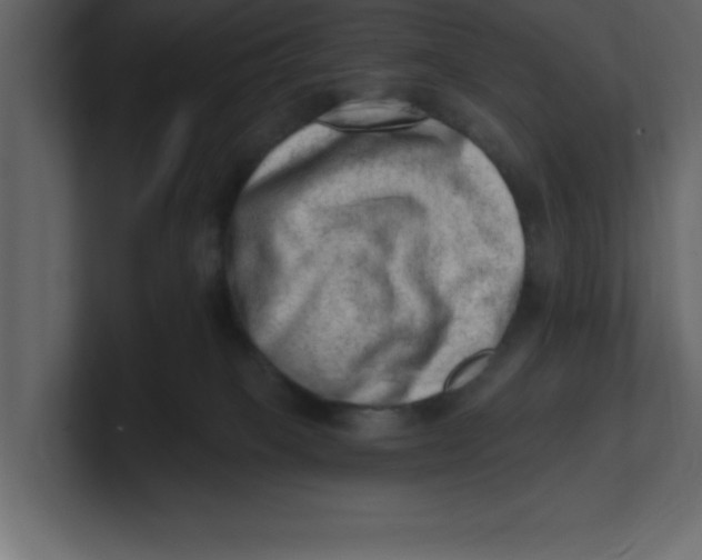 X0000100960085200807151407