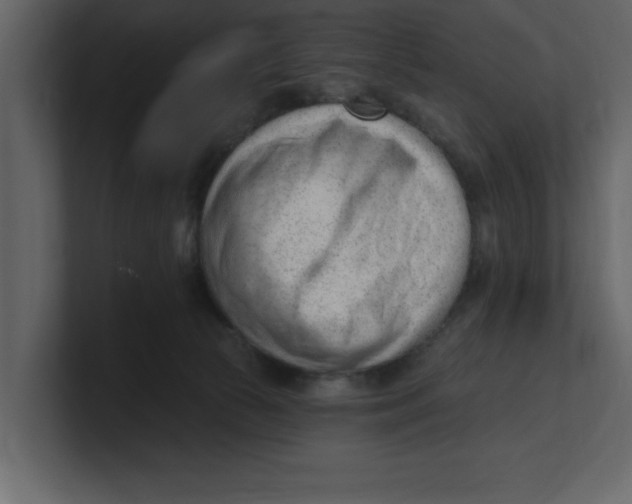 X0000100960177200807151406