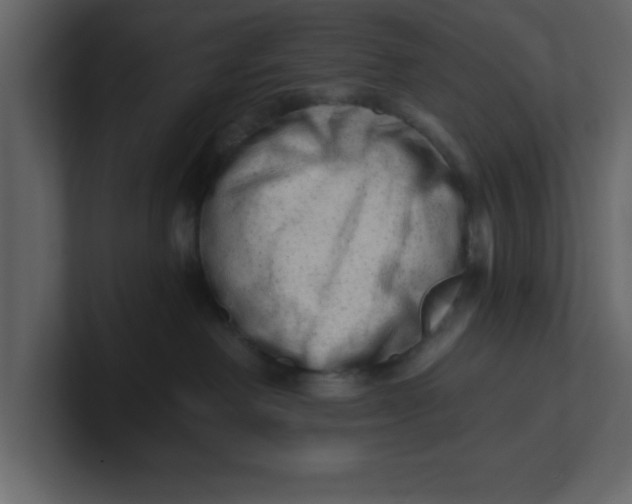 X0000100960238200807151405