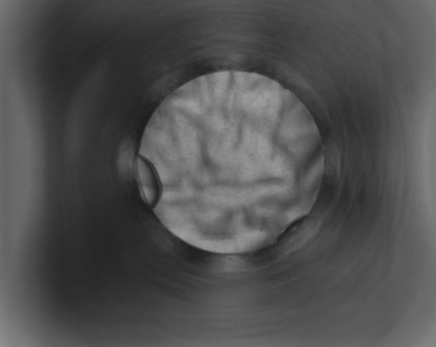 X0000100960287200807151405