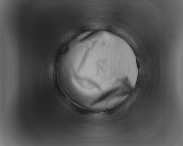 X0000100960306200807151404