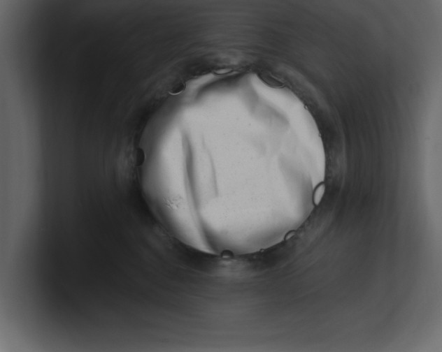 X0000100960376200807151403