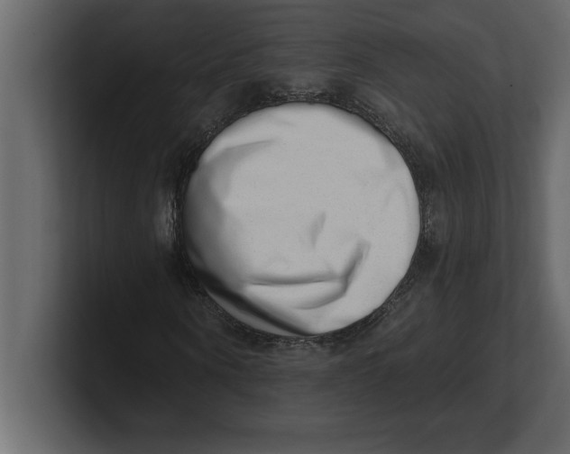 X0000100960866200807151356