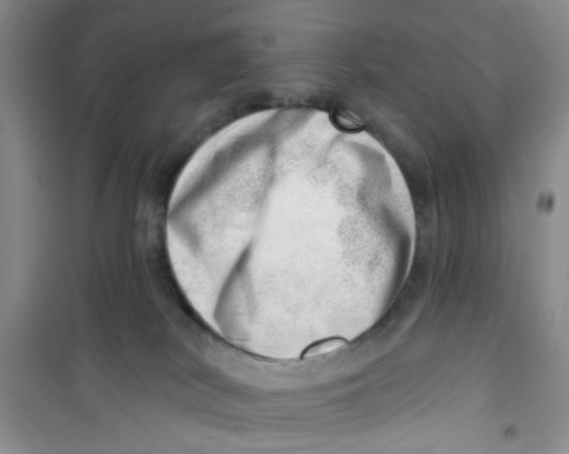 X0000100960038200807221156