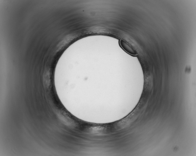 X0000100960158200807221153