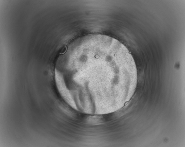 X0000100960179200807221154