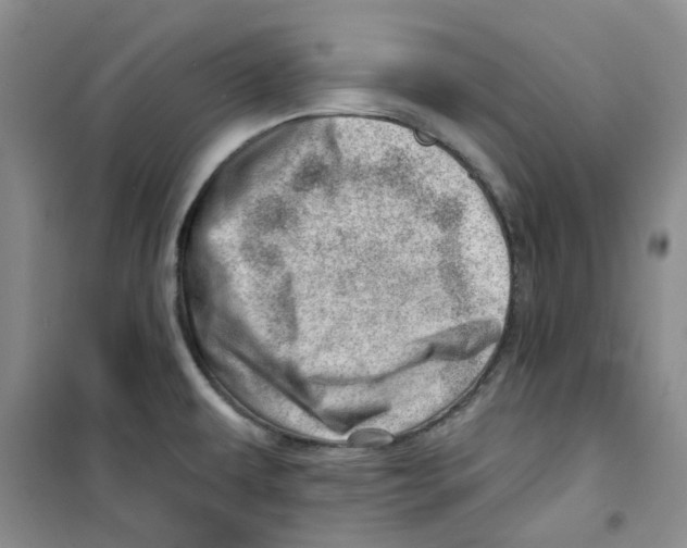 X0000100961479200807221133